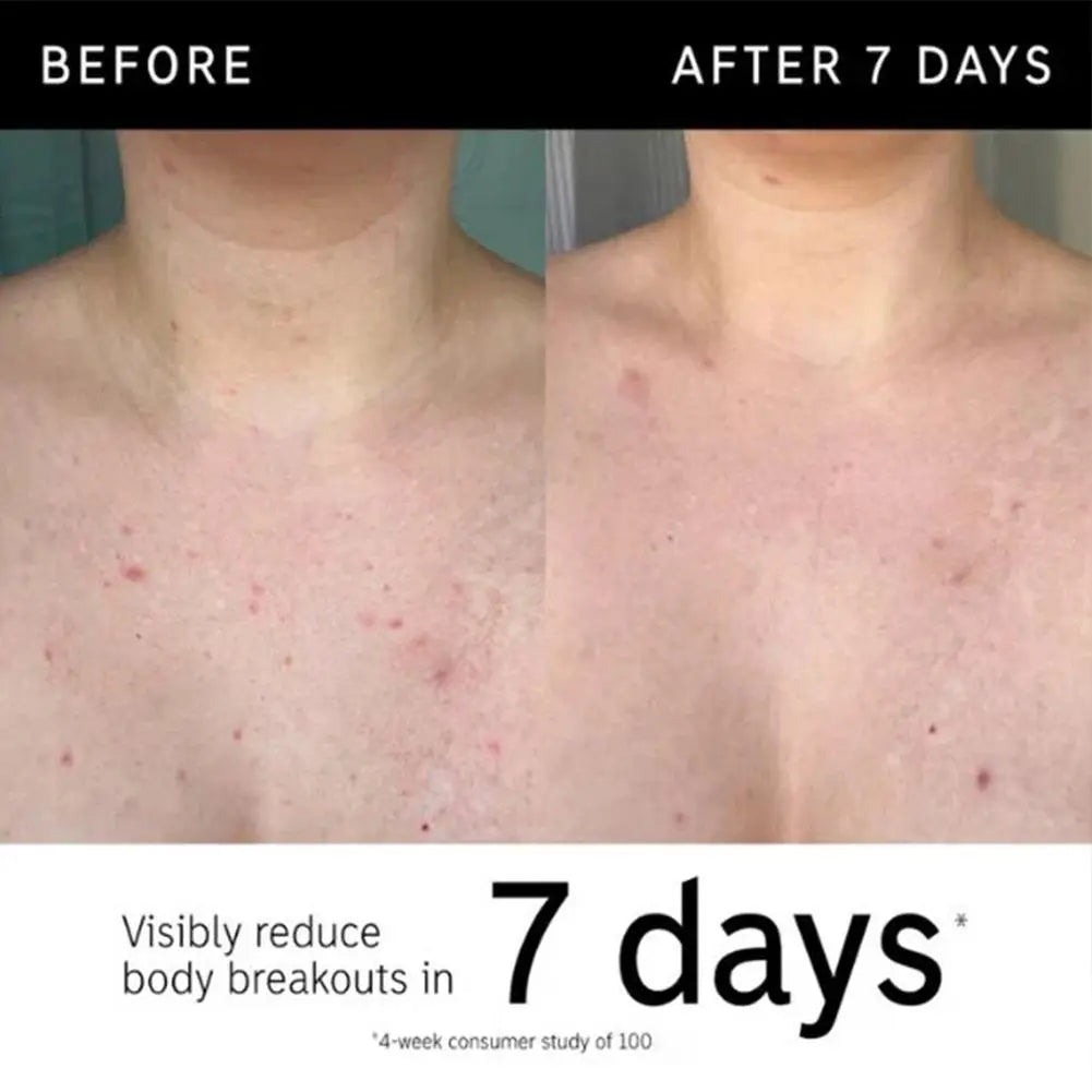 Barra exfoliante Corporal GA ClarifyLabs™